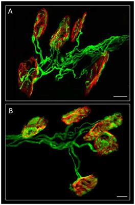 Membrane Receptor-Induced Changes of the Protein Kinases A and C Activity May Play a Leading Role in Promoting Developmental Synapse Elimination at the Neuromuscular Junction